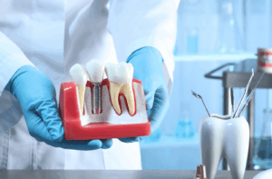 A dental professional wearing blue gloves and a lab coat holds a model of a dental implant inserted into a jawbone model, demonstrating the procedure.