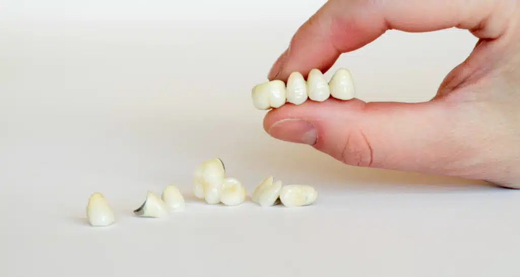 Hand holding a dental bridge with multiple artificial teeth