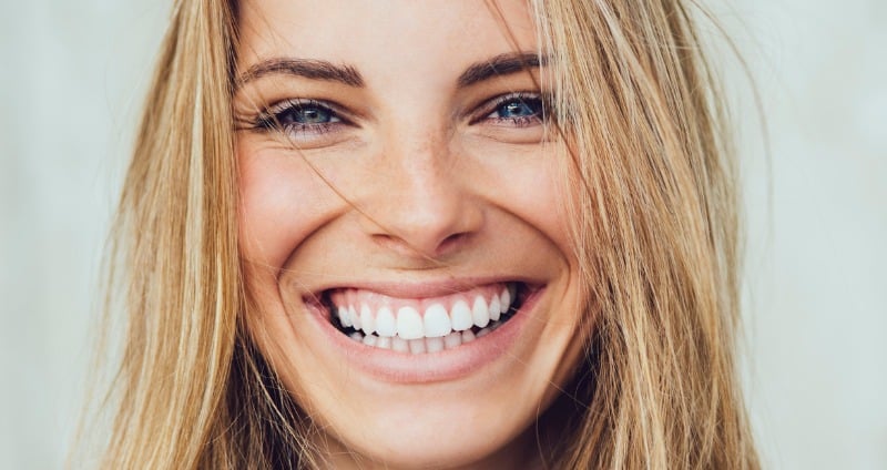 Woman showing a bright white smile after cosmetic dental veneers smile makeover treatment